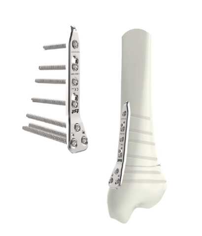 placa lcp tibia distal