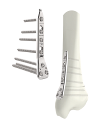 placa lcp tibia distal2
